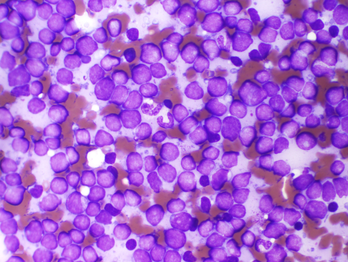 Touch preparation BM 500x